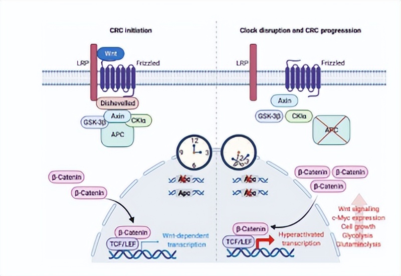 结直肠癌一般发病年龄,结直肠癌的诱因及病因
