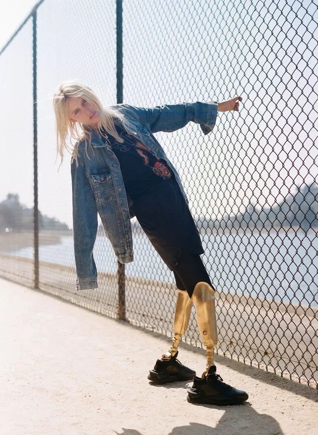 超模用卫生棉条感染截肢励志,一名超模因卫生棉截肢