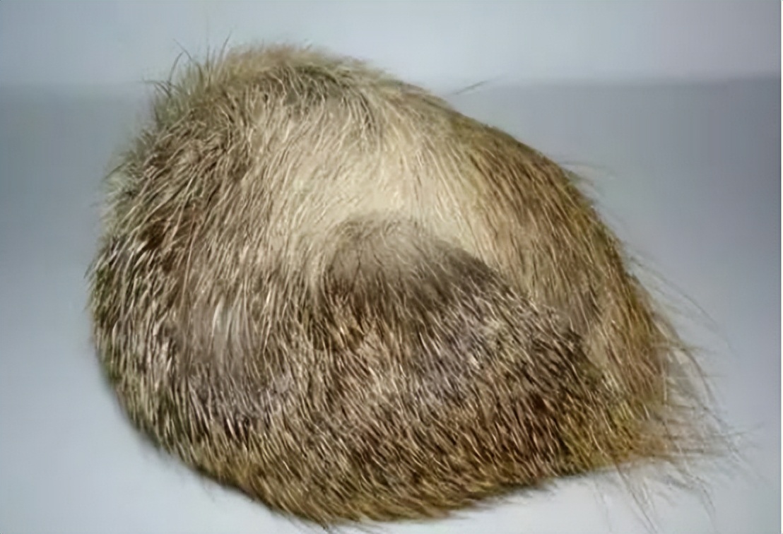 长期服用通心络麝香保心丸的好处,常吃麝香保心丸会便秘吗