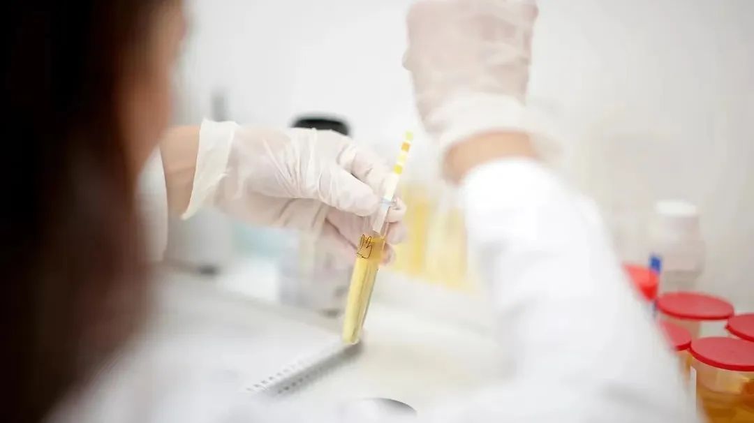 教您轻松解读化验单之尿常规,尿常规化验单粘液丝解读