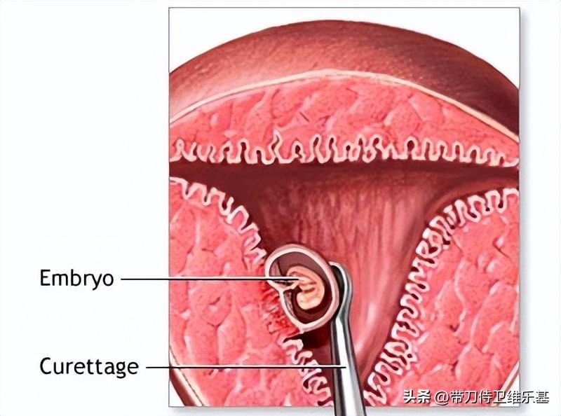 专家说生育率下降的原因原版采访,生育率下跌的原因调查报告