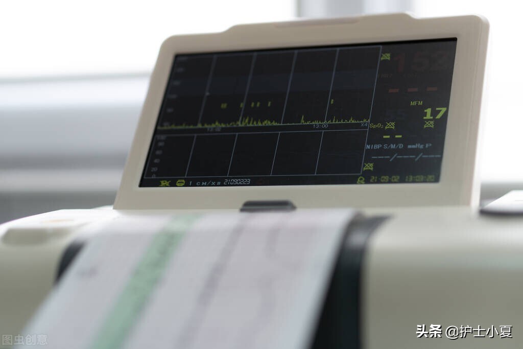 胎儿心律失常怎么办,胎儿心律失常呈三联律