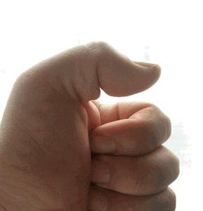 颈肩针灸要多久才能治好,弹响指做针灸能彻底根治吗