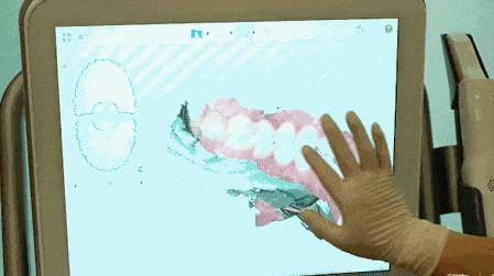 最新通知看牙补贴,马上领取种牙补贴