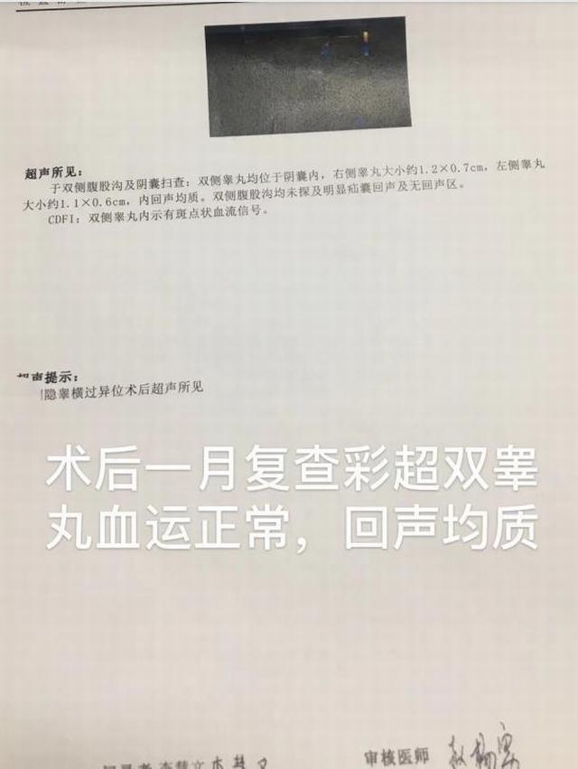 宝宝只有一个睾丸是什么原因,儿科睾丸只有一个还小是怎么回事