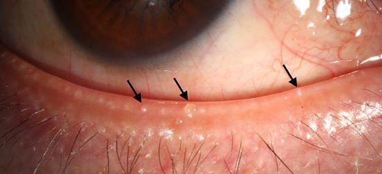 常德市爱尔眼科激光手术,常德武陵区爱尔眼科医院