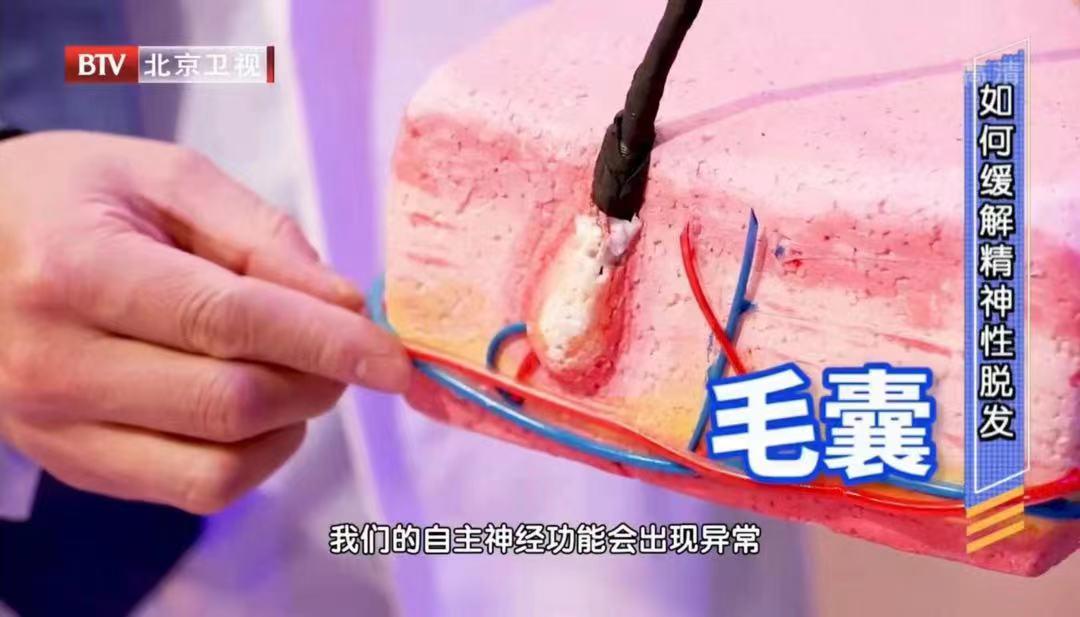 天天洗头容易脱发,天天洗头越来越油什么原因