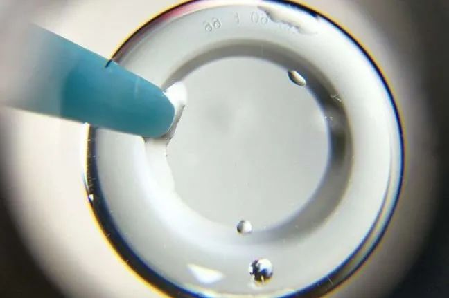 角膜塑形镜到底值不值得戴,角膜塑形镜最多戴几个小时