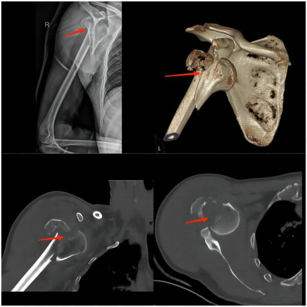 健康小知识运动损伤的常见症状,运动损伤知识科普宣传内容