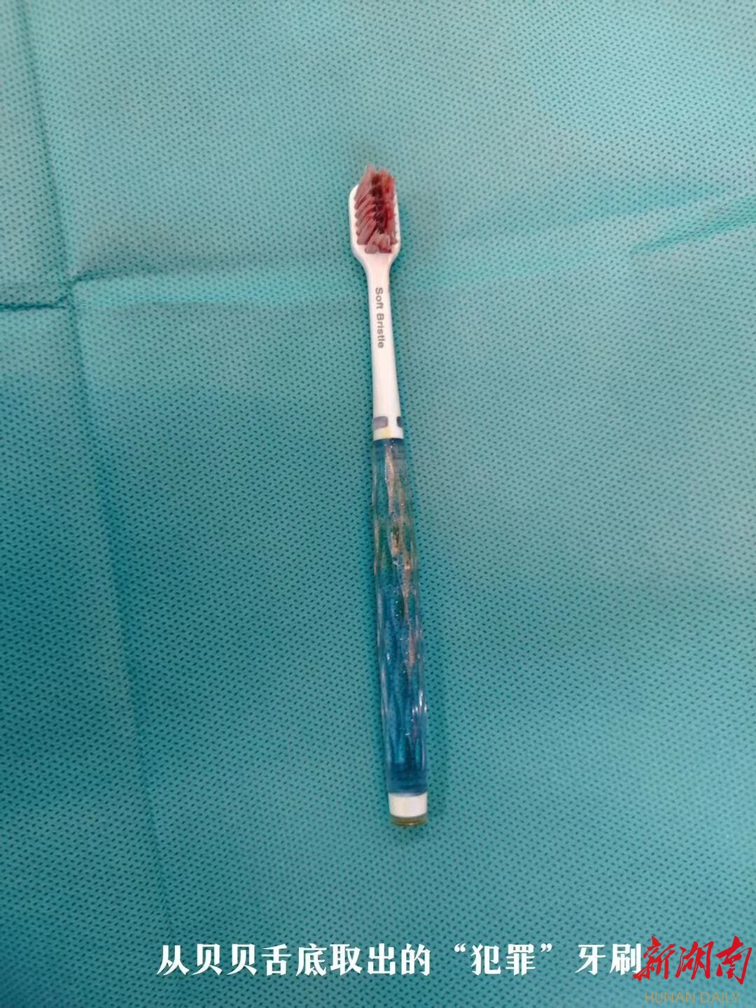 牙刷卡在喉咙里小妙招,科普异物卡喉成人互救急救方法