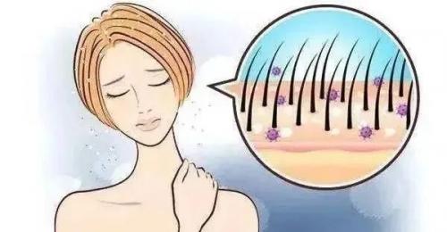 大麦植发毛囊炎用药,毛囊炎会导致植发失败吗