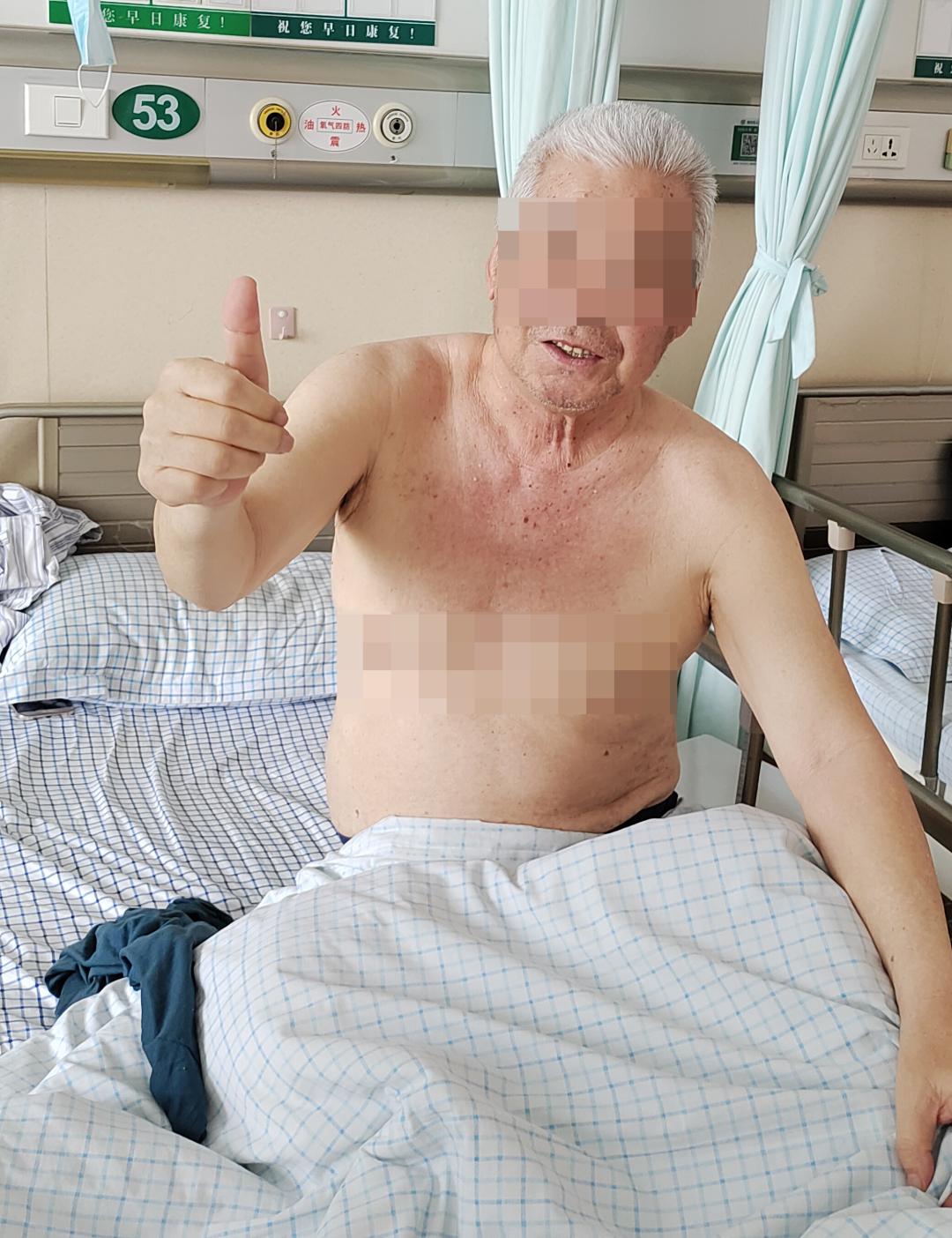 脊髓神经调控技术治疗瘫痪,最新技术治疗中枢神经