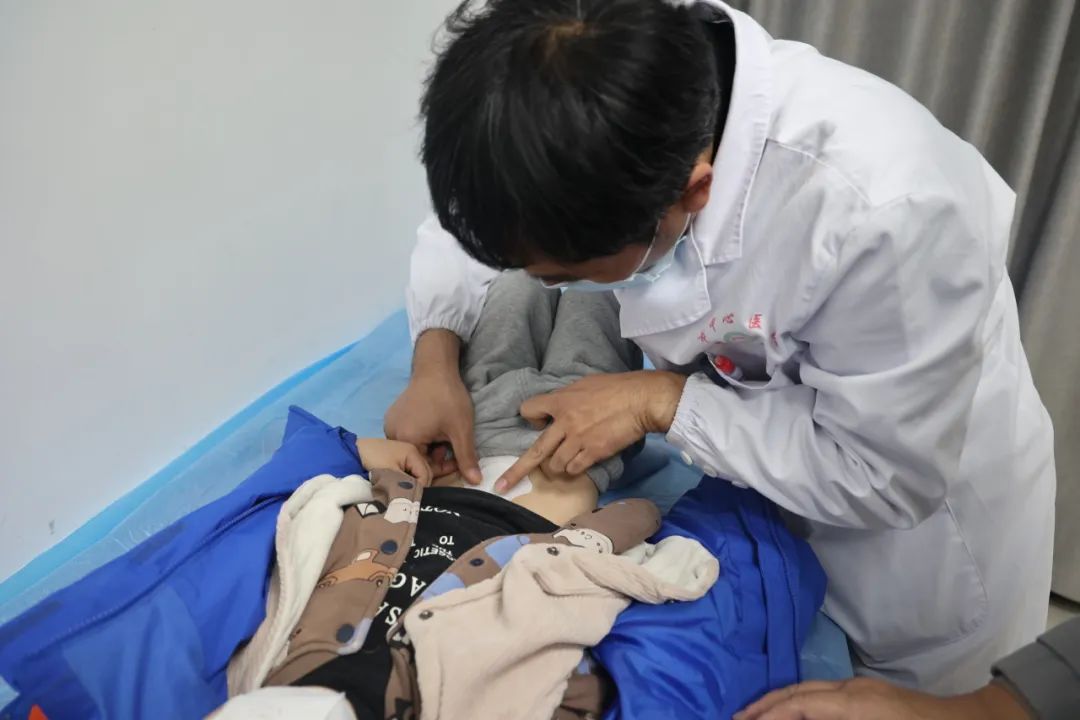 市中心医院中医外治解决小儿厌食